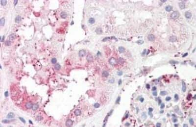 Immunohistochemistry-Paraffin: ERG28 Antibody [NBP3-14314]